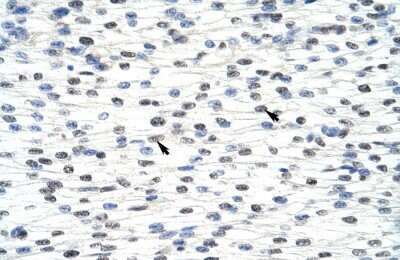 Immunohistochemistry-Paraffin: ADAT1 Antibody [NBP1-57220]