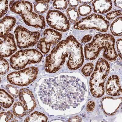 Immunohistochemistry-Paraffin: ADAT1 Antibody [NBP1-85850]