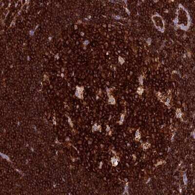 Immunohistochemistry-Paraffin: ADAT1 Antibody [NBP1-86237]