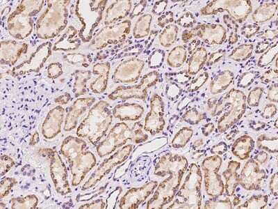 Immunohistochemistry-Paraffin: ADAT1 Antibody [NBP2-97762]