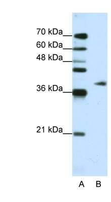 Western Blot: ADAT1 Antibody [NBP1-57220]