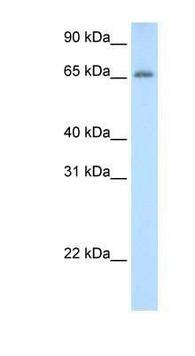 Western Blot: ADAT1 Antibody [NBP1-57221]