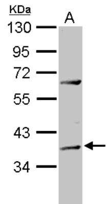 Western Blot: ADAT1 Antibody [NBP2-15288]