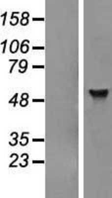 Western Blot: ADAT1 Overexpression Lysate [NBL1-07323]