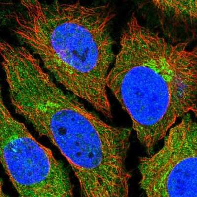 Immunocytochemistry/ Immunofluorescence: ADAT2 Antibody [NBP1-84285]