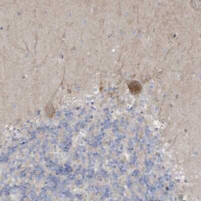 Immunohistochemistry-Paraffin: ADAT2 Antibody [NBP1-84285]