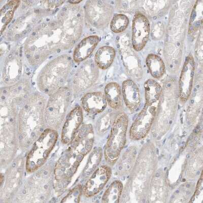 Immunohistochemistry-Paraffin: ADAT2 Antibody [NBP1-84285]