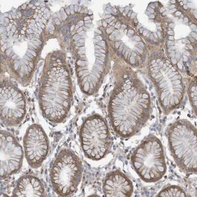 Immunohistochemistry-Paraffin: ADAT2 Antibody [NBP1-84285]