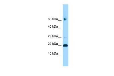 Western Blot: ADAT2 Antibody [NBP2-82556]