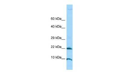 Western Blot: ADAT2 Antibody [NBP2-82557]