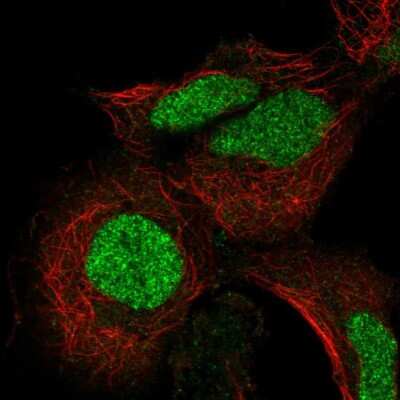 Immunocytochemistry/ Immunofluorescence: ADAT3 Antibody [NBP2-31732]