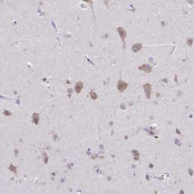 Immunohistochemistry-Paraffin: ADAT3 Antibody [NBP2-31732]