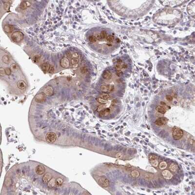 Immunohistochemistry-Paraffin: ADAT3 Antibody [NBP2-31732]