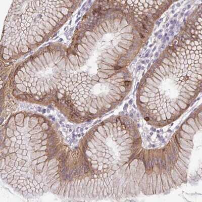 Immunohistochemistry-Paraffin: ADAT3 Antibody [NBP2-31732]