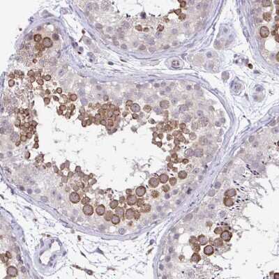 Immunohistochemistry-Paraffin: ADAT3 Antibody [NBP2-31732]