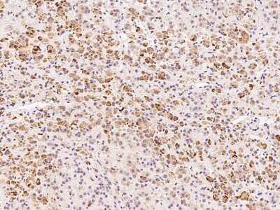 Immunohistochemistry-Paraffin: ADAT3 Antibody [NBP2-99169]