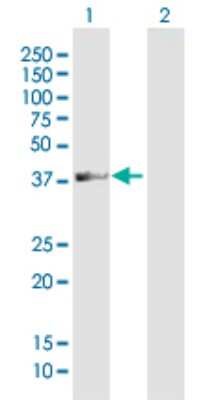 Western Blot: ADAT3 Antibody [H00113179-B01P]