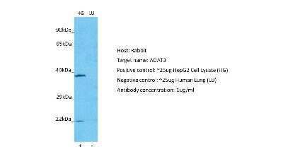 Western Blot: ADAT3 Antibody [NBP2-84394]