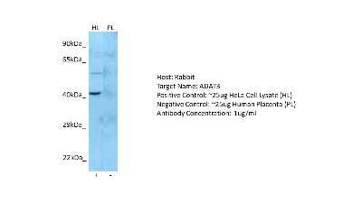 Western Blot: ADAT3 Antibody [NBP2-84395]