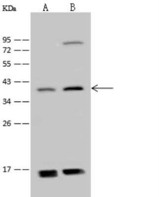 Western Blot: ADAT3 Antibody [NBP2-99169]