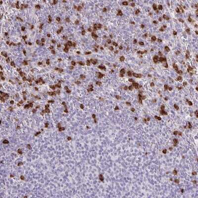 Immunohistochemistry-Paraffin: ADCK1 Antibody [NBP2-38746]
