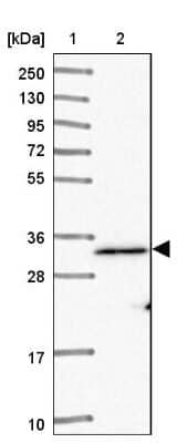 Western Blot: ADCK1 Antibody [NBP2-14267]