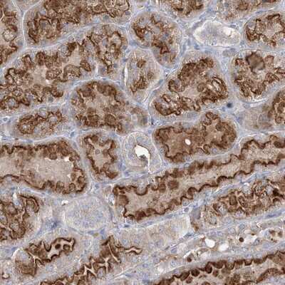 Immunohistochemistry-Paraffin: ADCK2 Antibody [NBP1-82736]