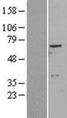 Western Blot: ADCK2 Overexpression Lysate [NBL1-07325]