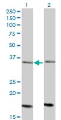 Western Blot: ADCK4 Antibody (1D9) [H00079934-M01]