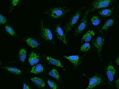 Immunocytochemistry/ Immunofluorescence: ADCK4 Antibody [NBP2-98583]