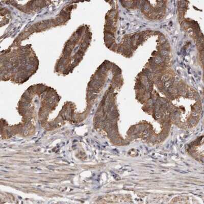 Immunohistochemistry-Paraffin: ADCK4 Antibody [NBP1-85508]