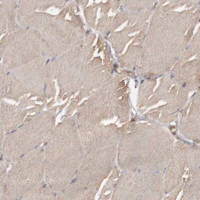 Immunohistochemistry-Paraffin: ADCK4 Antibody [NBP1-85508]