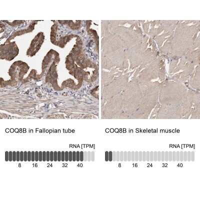 Immunohistochemistry-Paraffin: ADCK4 Antibody [NBP1-85508]