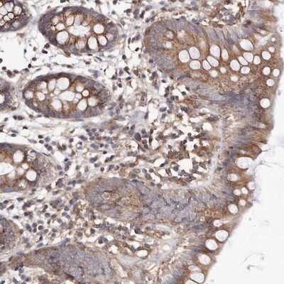 Immunohistochemistry-Paraffin: ADCK4 Antibody [NBP1-85509]