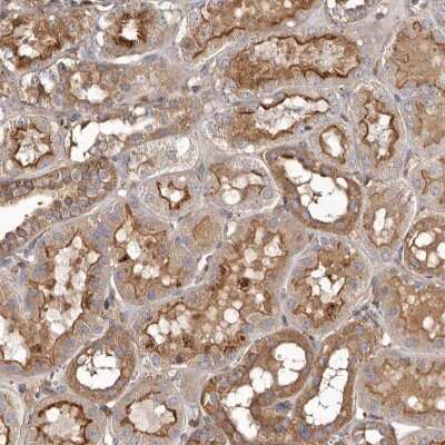 Immunohistochemistry-Paraffin: ADCK4 Antibody [NBP1-85510]