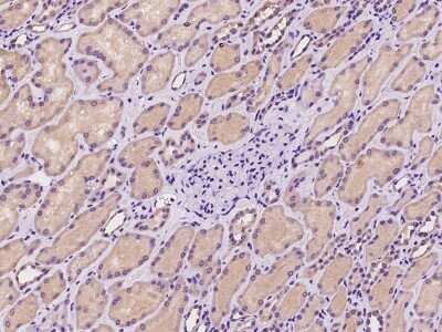 Immunohistochemistry-Paraffin: ADCK4 Antibody [NBP2-98583]