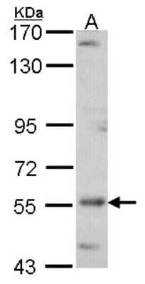 Western Blot: ADCK4 Antibody [NBP1-31992]