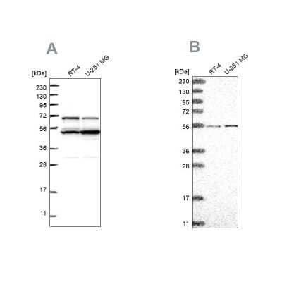 Western Blot: ADCK4 Antibody [NBP1-85508]