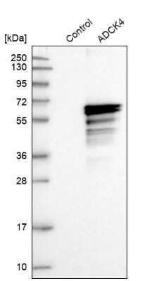Western Blot: ADCK4 Antibody [NBP1-85509]