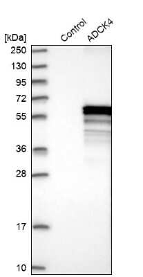 Western Blot: ADCK4 Antibody [NBP1-85510]