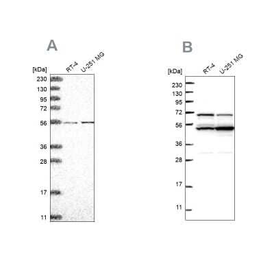 Western Blot: ADCK4 Antibody [NBP2-58814]