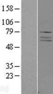 Western Blot: ADCK4 Overexpression Lysate [NBP2-09659]