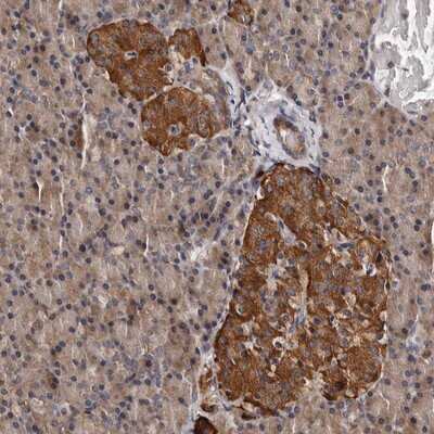 Immunohistochemistry-Paraffin: ADCK5 Antibody [NBP1-83500]