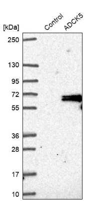 Western Blot: ADCK5 Antibody [NBP1-83500]