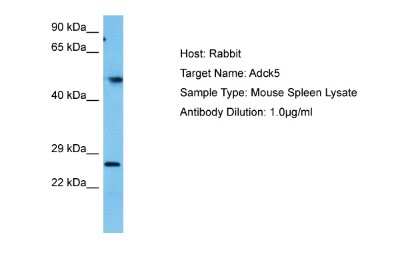 Western Blot: ADCK5 Antibody [NBP2-84398]