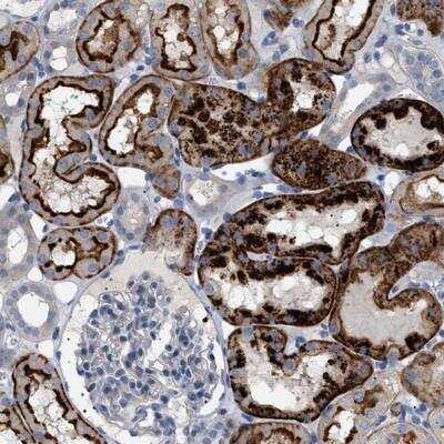 Immunohistochemistry-Paraffin: ADCY10 Antibody [NBP1-81765]