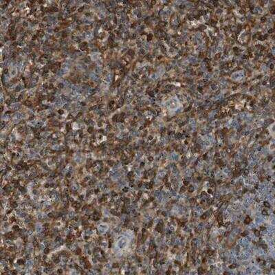 Immunohistochemistry-Paraffin: ADCY10 Antibody [NBP1-81766]