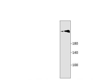 Western Blot: ADCY10 Antibody [NBP3-12378]