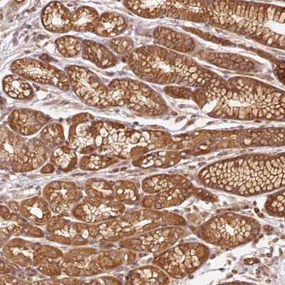 Immunohistochemistry: ADCY4 Antibody [NBP2-37920]