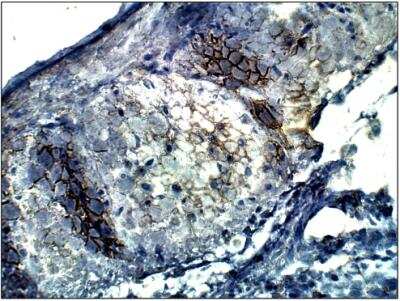 Immunohistochemistry-Paraffin: ADCY4 Antibody [NBP3-12214]